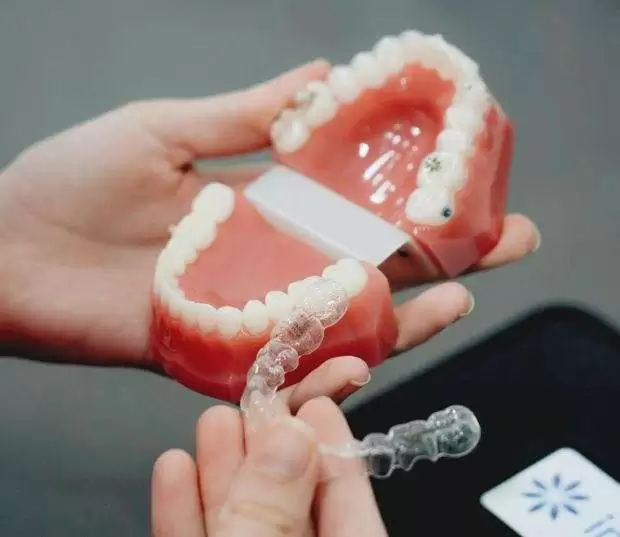 Custom Aligners