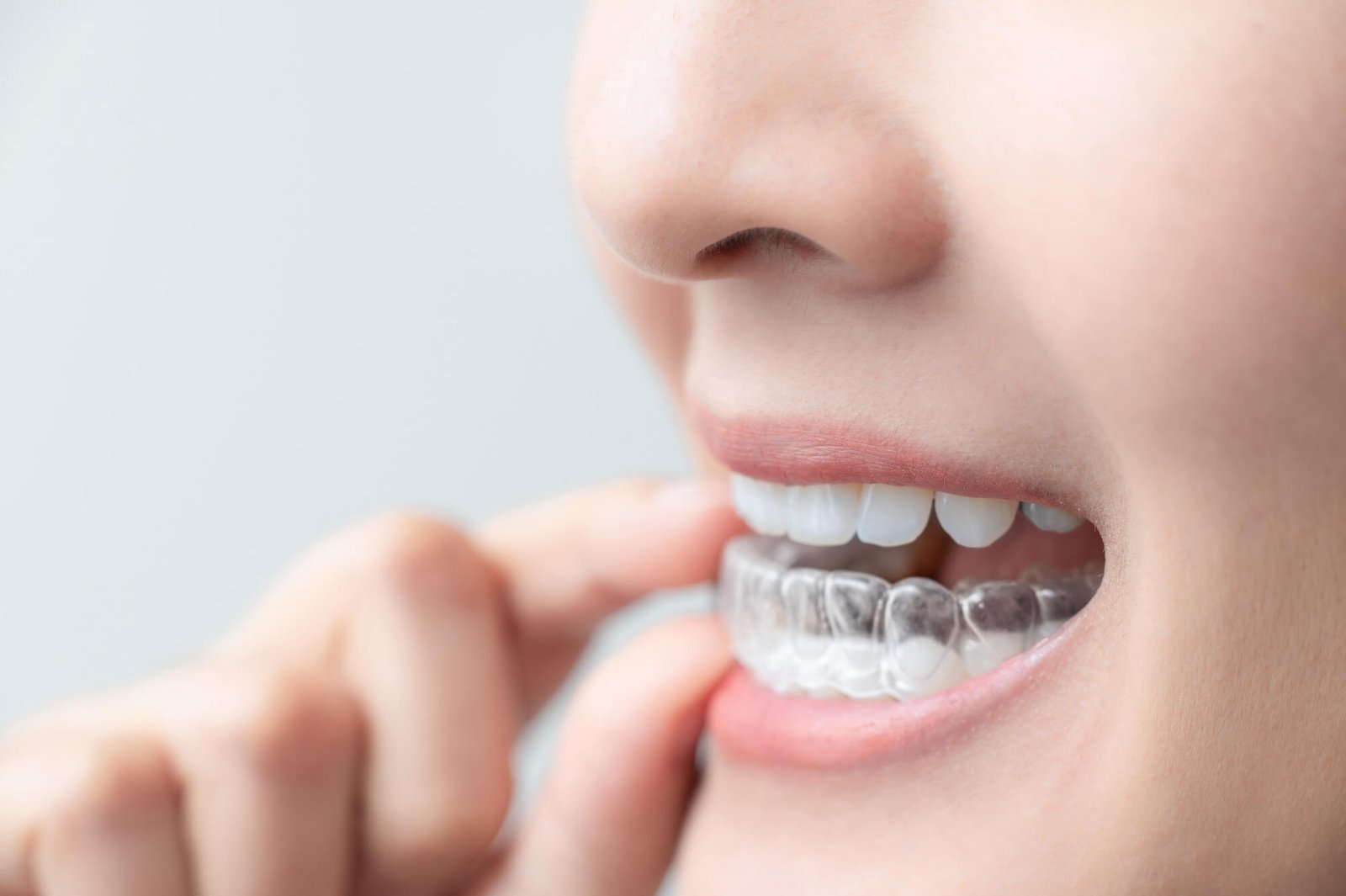 Retainers